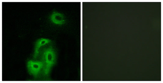 SR-2A Rabbit Polyclonal Antibody