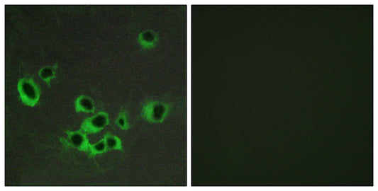SR-2B Rabbit Polyclonal Antibody