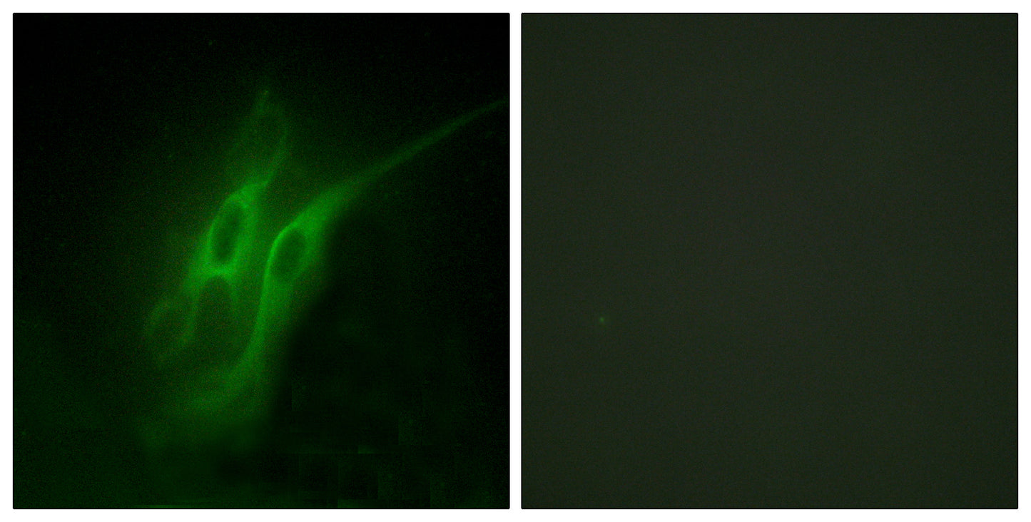 SR-4 Rabbit Polyclonal Antibody