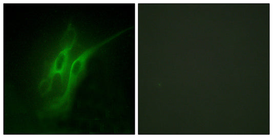 SR-4 Rabbit Polyclonal Antibody