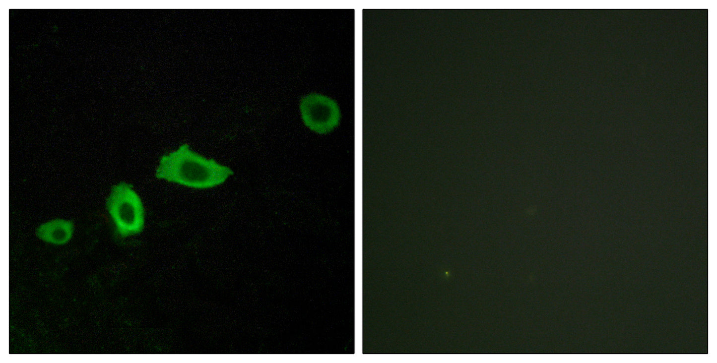 SR-5A Rabbit Polyclonal Antibody