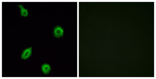 SR-5B Rabbit Polyclonal Antibody