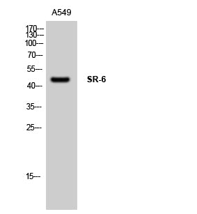 SR-6 Rabbit Polyclonal Antibody