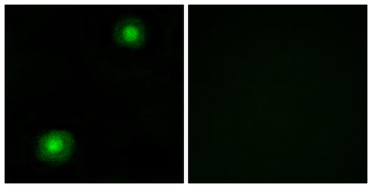SRE-ZBP Rabbit Polyclonal Antibody