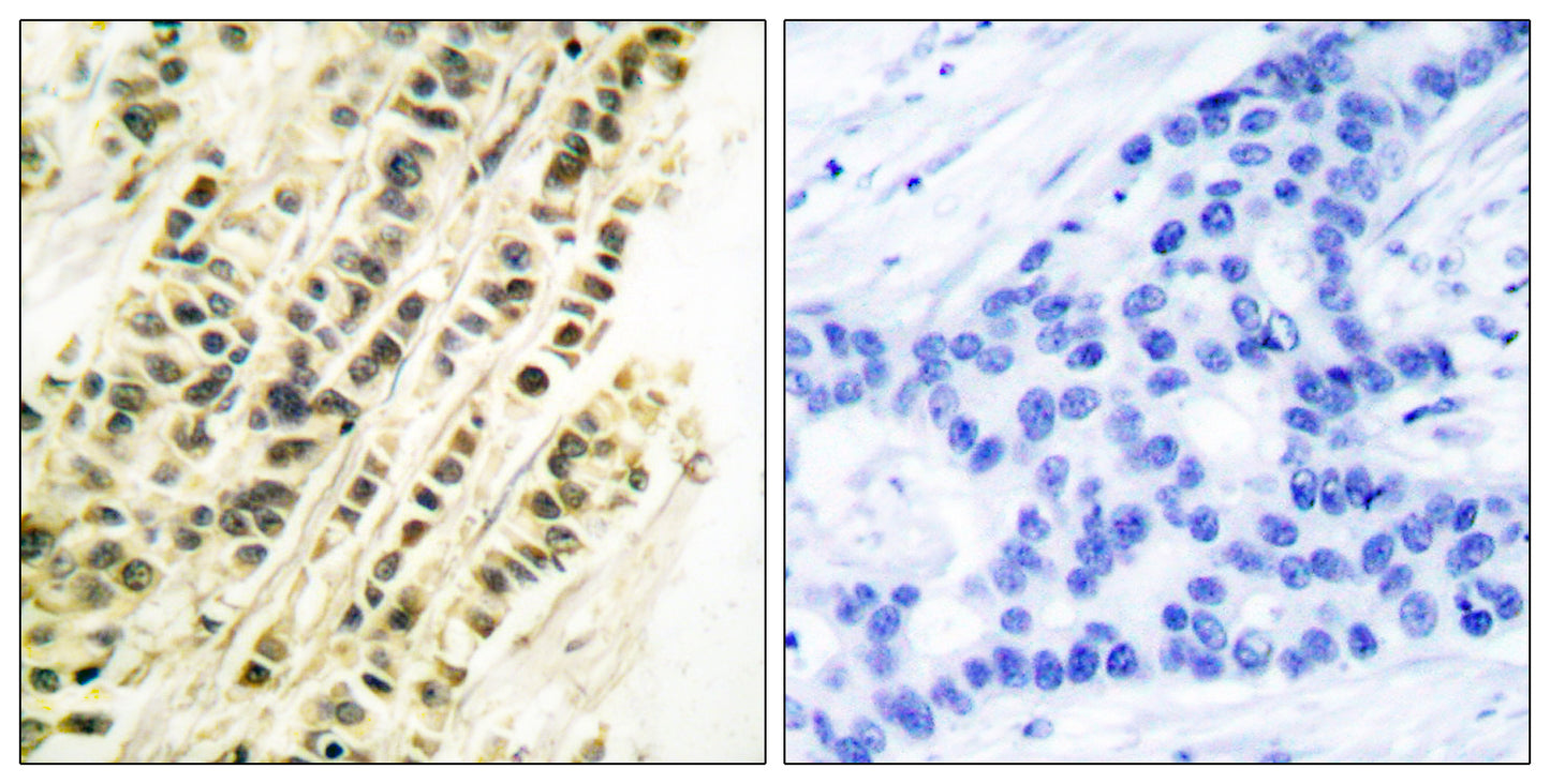 SRF Rabbit Polyclonal Antibody