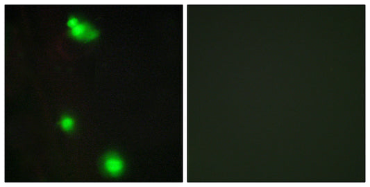 SRp20 Rabbit Polyclonal Antibody