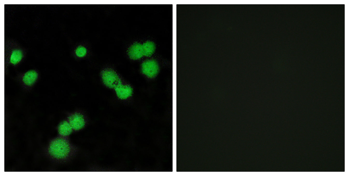 SRp40 Rabbit Polyclonal Antibody