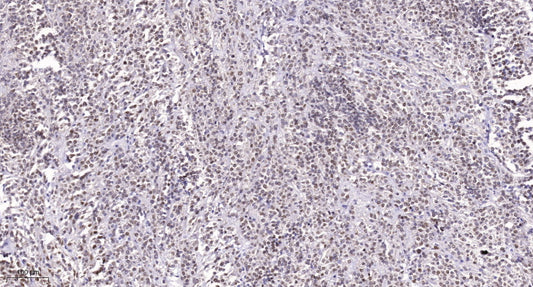 SRp55 Rabbit Polyclonal Antibody