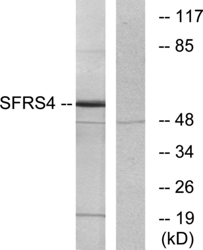 SRp75 Rabbit Polyclonal Antibody