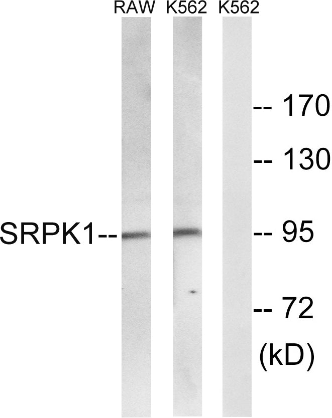 SRPK1 Rabbit Polyclonal Antibody