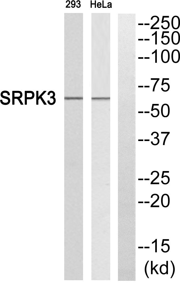 SRPK3 Rabbit Polyclonal Antibody