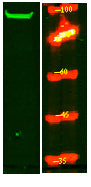 SRRM1 Rabbit Polyclonal Antibody