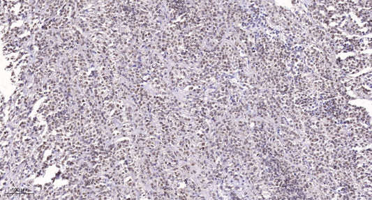 SRRM2 Rabbit Polyclonal Antibody