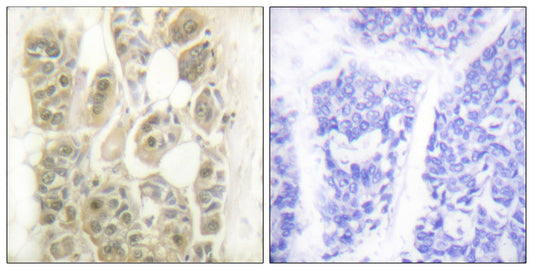 SSB Rabbit Polyclonal Antibody