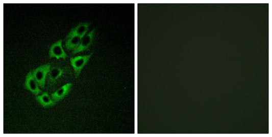 SSBP1 Rabbit Polyclonal Antibody