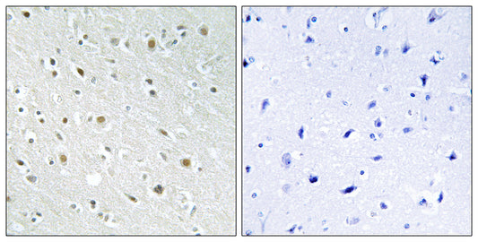 SSBP2 Rabbit Polyclonal Antibody