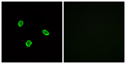 SSTR1 Rabbit Polyclonal Antibody