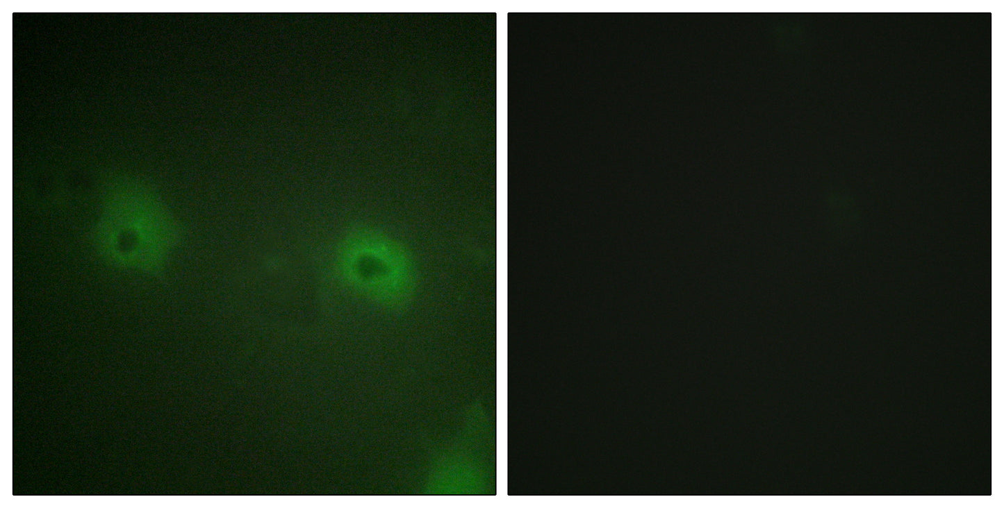 STAM2 Rabbit Polyclonal Antibody