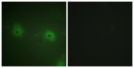 STAM2 Rabbit Polyclonal Antibody