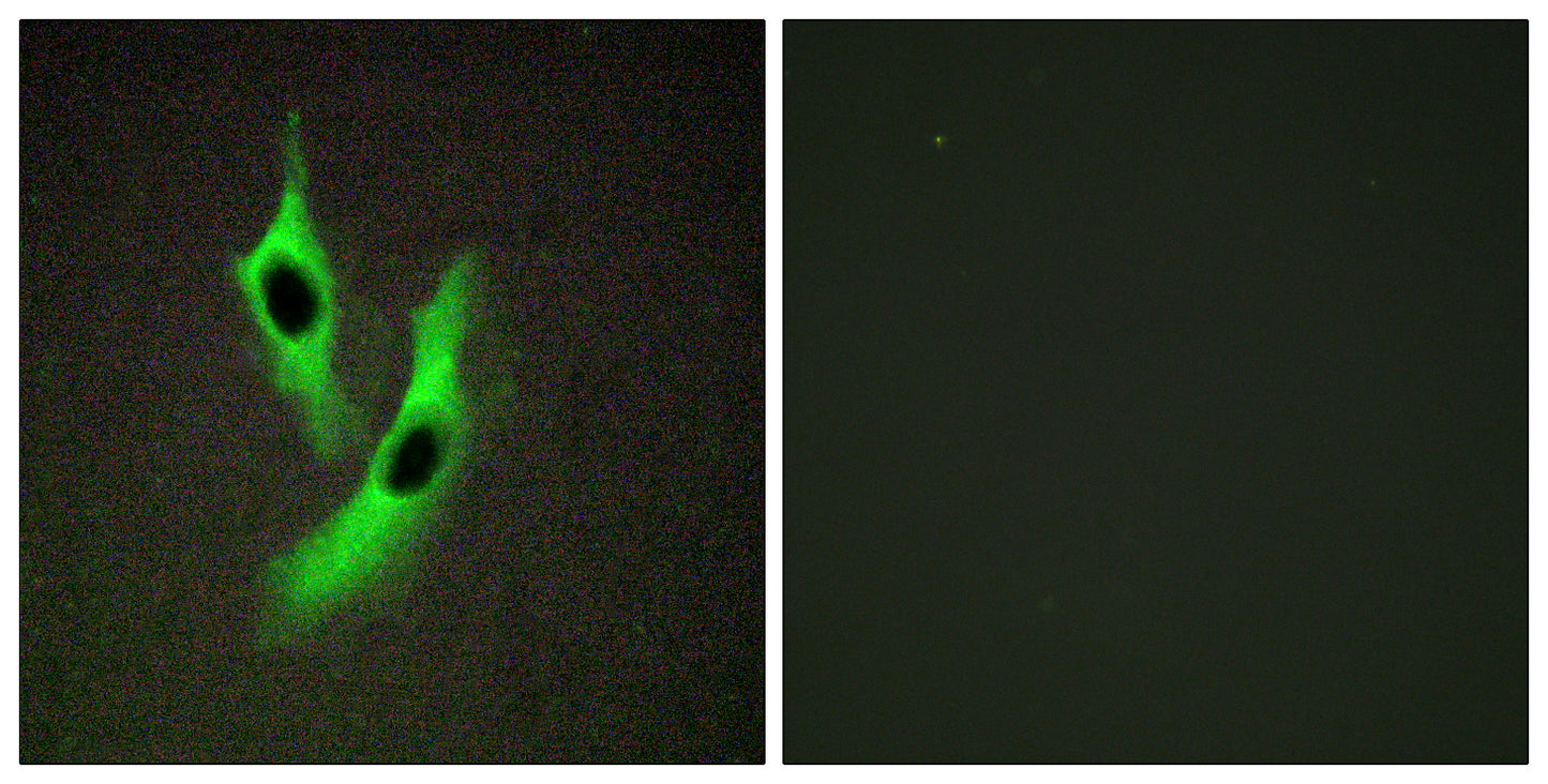 STAMP2 Rabbit Polyclonal Antibody