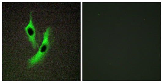 STAMP2 Rabbit Polyclonal Antibody