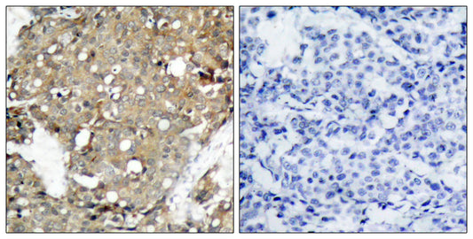 Stat1 Rabbit Polyclonal Antibody