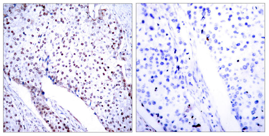 Stat3 Rabbit Polyclonal Antibody