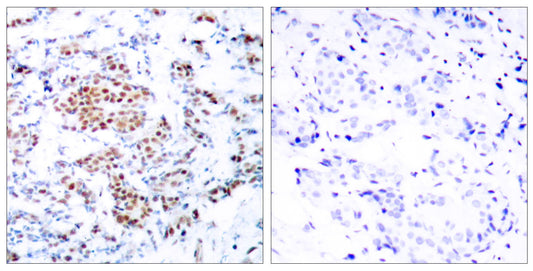 Stat5 Rabbit Polyclonal Antibody