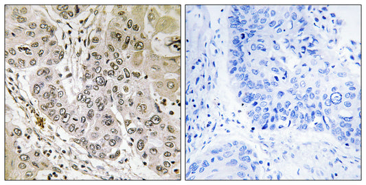 STK36 Rabbit Polyclonal Antibody