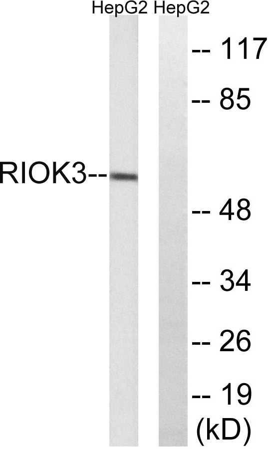 SUDD Rabbit Polyclonal Antibody