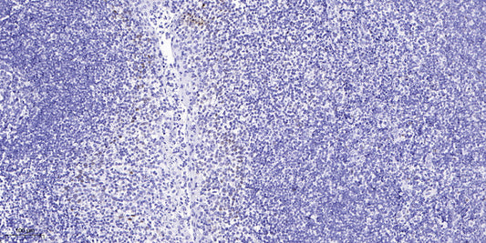 SUHW4 Rabbit Polyclonal Antibody