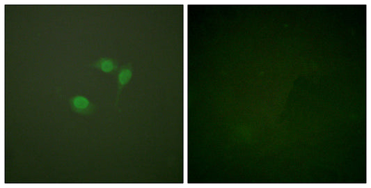 SUMO-1 Rabbit Polyclonal Antibody