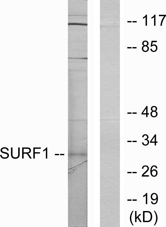 SURF-1 Rabbit Polyclonal Antibody