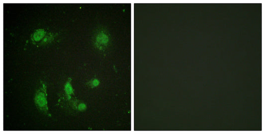 Survivin Rabbit Polyclonal Antibody
