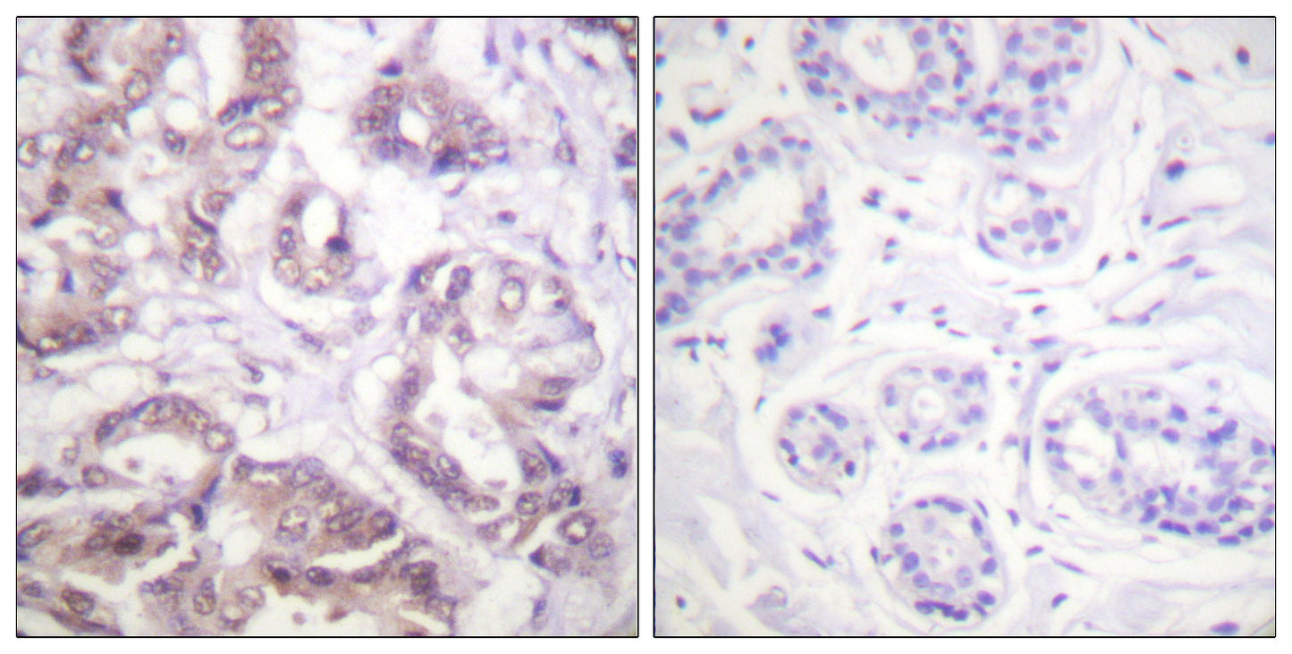 Survivin Rabbit Polyclonal Antibody