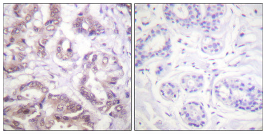 Survivin Rabbit Polyclonal Antibody
