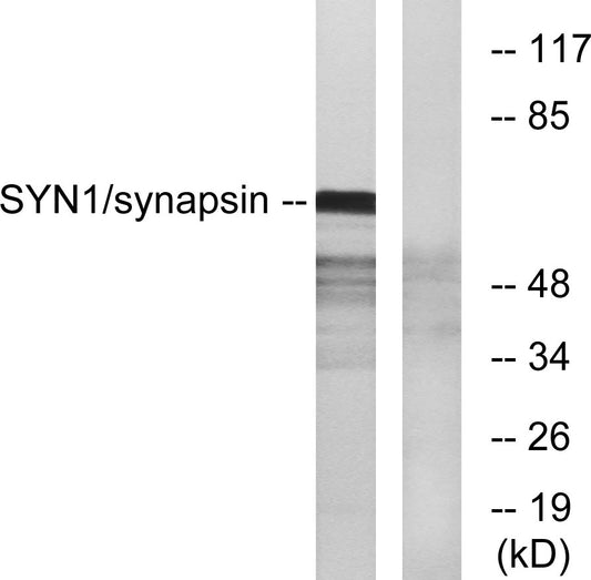Synapsin I Rabbit Polyclonal Antibody