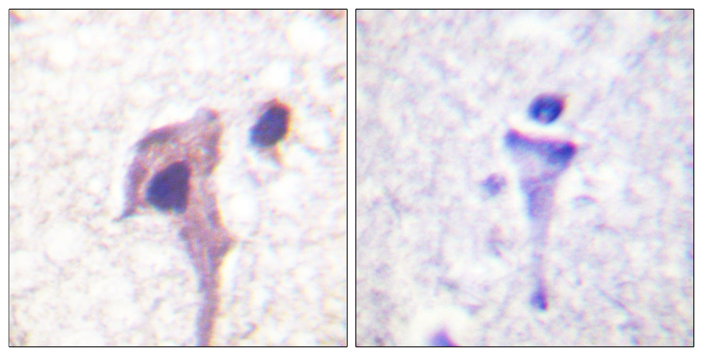Synapsin I Rabbit Polyclonal Antibody