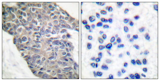 Synaptotagmin Rabbit Polyclonal Antibody