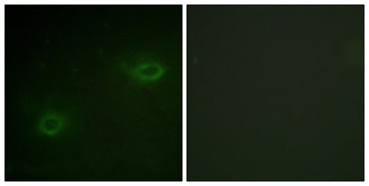 Syndecan-4 Rabbit Polyclonal Antibody