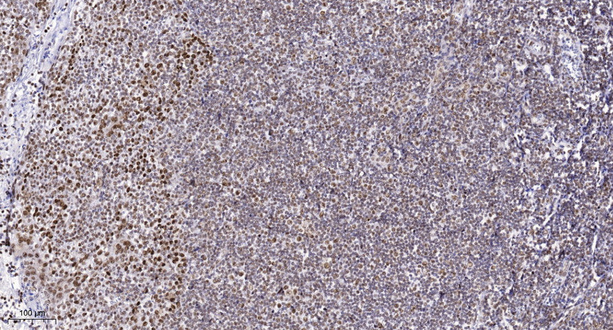SYNE2 Rabbit Polyclonal Antibody