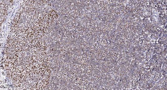 SYNE2 Rabbit Polyclonal Antibody