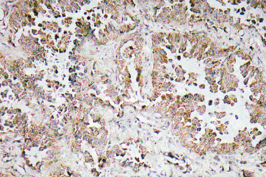 Synphilin-1 Rabbit Polyclonal Antibody