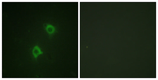 Syntaxin 1 Rabbit Polyclonal Antibody