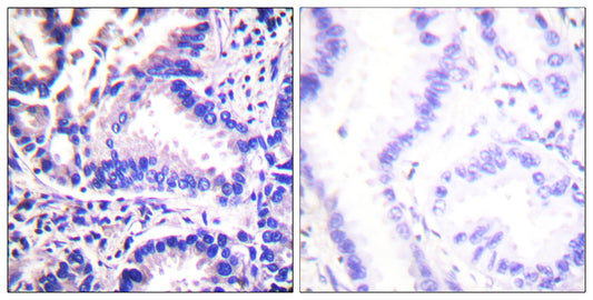 Synuclein-γ Rabbit Polyclonal Antibody