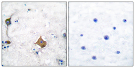 SYP Rabbit Polyclonal Antibody