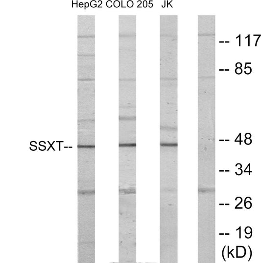 SYT Rabbit Polyclonal Antibody