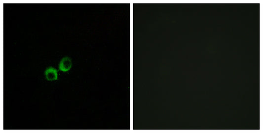 T1R3 Rabbit Polyclonal Antibody