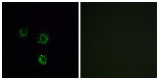 T2R14 Rabbit Polyclonal Antibody
