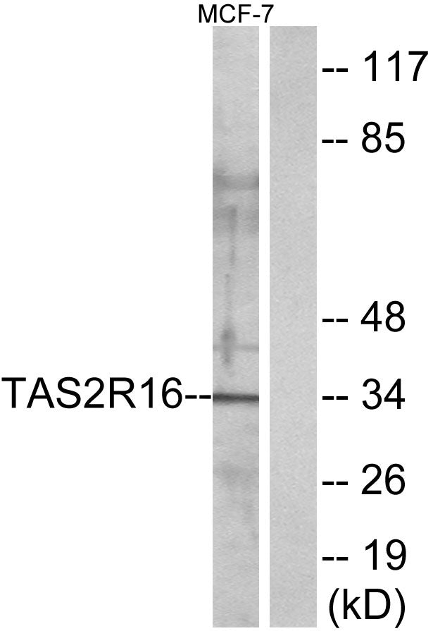 T2R16 Rabbit Polyclonal Antibody